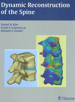 Dynamic Reconstruction of the Spine (Hardcover)