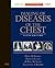 Imaging of Diseases of the Chest: Expert Consult - Online and Print