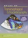 Atlas of Transesophageal Echocardiography Atlas of Transesophageal Echocardiography