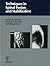 Techniques in Spinal Fusion and Stabilization