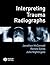Interpreting Trauma Radiographs