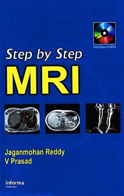 Step by Step MRI (Paperback)