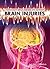 Brain Injuries (Understanding Brain Diseases and Disorders)