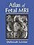 Atlas of Fetal MRI