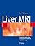 Liver MRI: Correlation with other Imaging Modalities and Histopathology