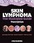 Skin Lymphoma: The Illustrated Guide