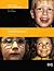 Strabismus by Francis A. Billson