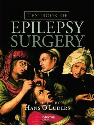 Textbook of Epilepsy Surgery (Hardcover)
