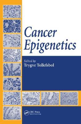 Cancer Epigenetics (Hardcover)