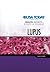 Lupus (USA TODAY Health Reports: Diseases and Disorders)