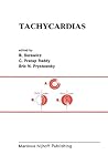 Tachycardias by Borys Surawicz