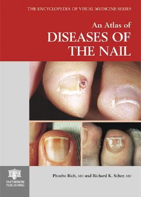 An Atlas of Diseases of the Nail (Encyclopedia of Visual Medicine Series)