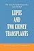 Lupus and Two Kidney Transplants