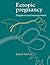 Ectopic Pregnancy: Diagnosis and Management (Volume 0)