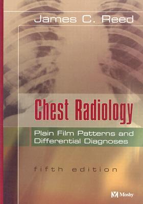 Chest Radiology -- Plain Film Patterns and Differential Diagnoses (Hardcover)
