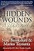 Hidden Wounds: A Soldier's ...