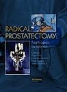 Radical Prostatectomy: From Open to Robotic