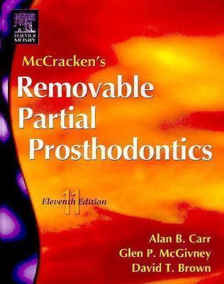 McCracken's Removable Partial Prosthodontics (Hardcover)