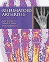 Rheumatoid Arthritis Rheumatoid Arthritis