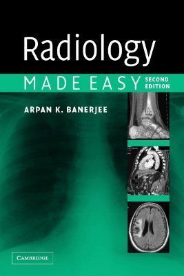 Radiology Made Easy (Paperback)