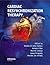 Cardiac Resynchronization Therapy