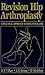 Revision Hip Arthroplasty: ...