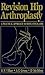 Revision Hip Arthroplasty by Richard Villar