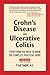 Crohn's Disease and Ulcerative Colitis by Fred Saibil