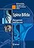 Spina Bifida: Management and Outcome