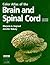 Color Atlas of the Brain an...