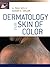 Dermatology for Skin of Color