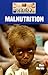Malnutrition (Diseases and Disorders)