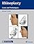 Rhinoplasty: Cases and Techniques