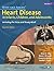 Moss and Adams' Heart Disease in Infants, Children and Adoles... by Hugh D. Allen