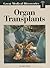 Organ Transplants (Great Medical Discoveries)