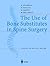 The Use of Bone Substitutes in Spine Surgery: A State of the Art Review