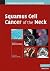 Squamous Cell Cancer of the Neck (Contemporary Issues in Cancer Imaging)