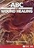 of Wound Healing by Joseph Grey