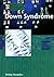 Down Syndrome (Genetic Diseases)