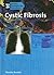 Cystic Fibrosis by Maxine Rosaler