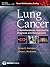 Lung Cancer: A Multidiscipl...