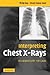 Interpreting Chest X-Rays: Illustrated with 100 Cases