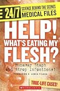 Help! What's Eating My Flesh?: Runaway Staph and Strep Infections!