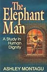 The Elephant Man : A Study in Human Dignity The Elephant Man : A Study in Human Dignity