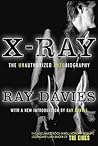 X-ray by davies-ray