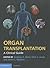 Organ Transplantation: A Cl...