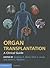 Organ Transplantation by Andrew A. Klein