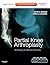 Partial Knee Arthroplasty: Techniques for Optimal Outcomes with DVD; Expert Consult - Online & Print
