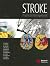 Stroke: Practical Management