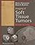 Imaging of Soft Tissue Tumors